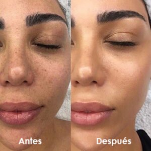 antes.jpg